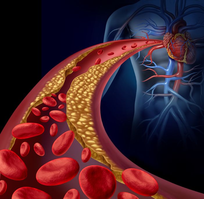 hydrogen-and-oxygen-nanobubbles-an-innovative-therapy-for-cardiovascular-disease